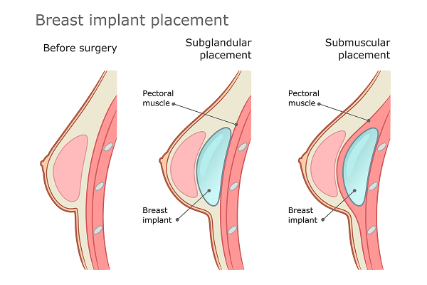 Reconstruct, Restore, Redefine: Three Pillars of Modern Plastic Surgery